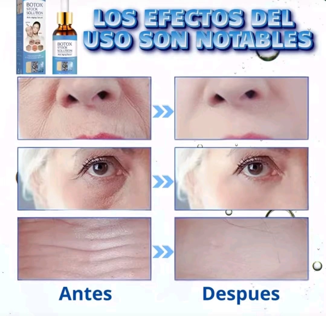 Bótox sin agujas-Rejuvenece tu rostro desde la primera aplicación💧