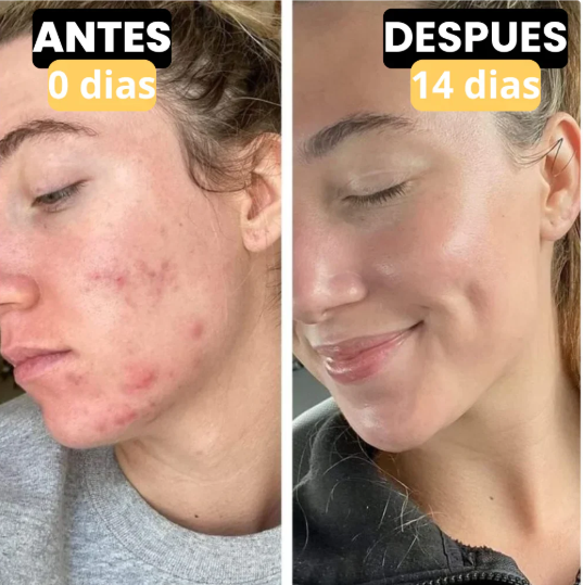 EVIL GOODS-SEBO DE RES🍯