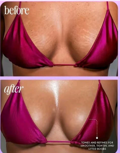 🌸TRULY FRESA Y VAINILLA : Dile adiós a manchas, vello enterrado y zonas oscuras🌸