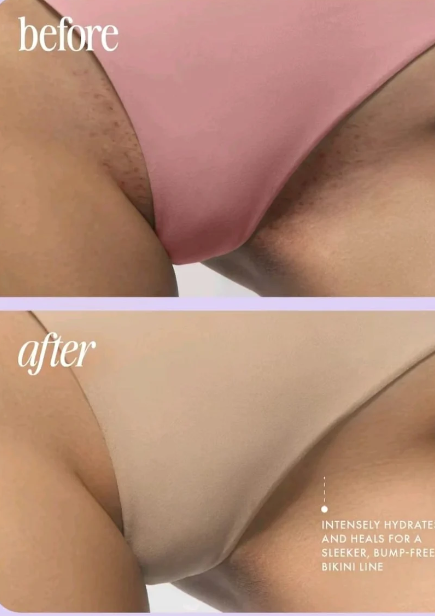 🌸TRULY FRESA Y VAINILLA : Dile adiós a manchas, vello enterrado y zonas oscuras🌸