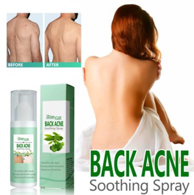 ADIÓS AL ACNÉ 🌿ELIMINA ESO GRANITOS💧