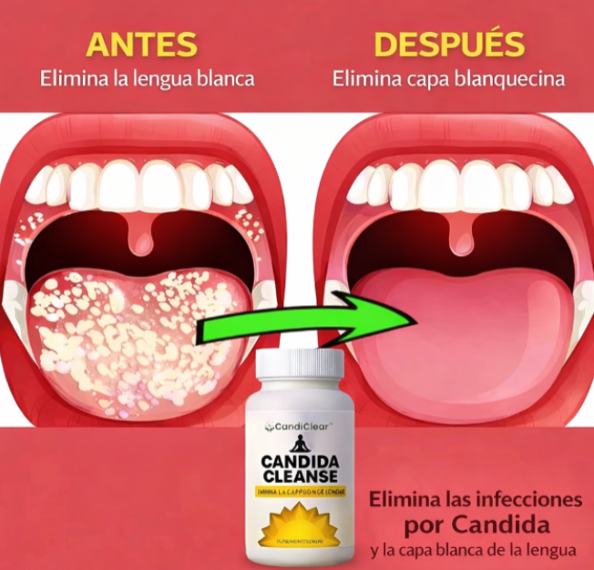 💊 CANDIDA CLEANSE –🌿 Empieza a cuidar tu bienestar desde dentro💊