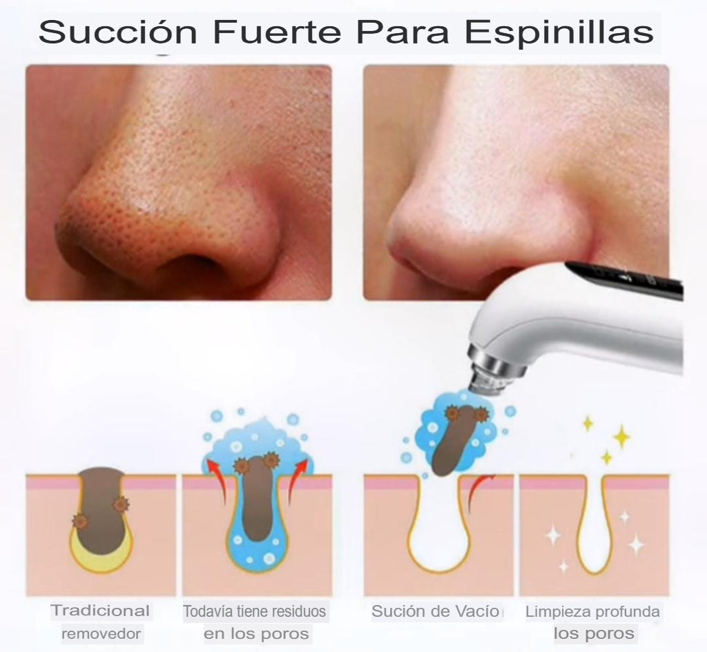 EXTRACTOR HIDROFACIAL💧