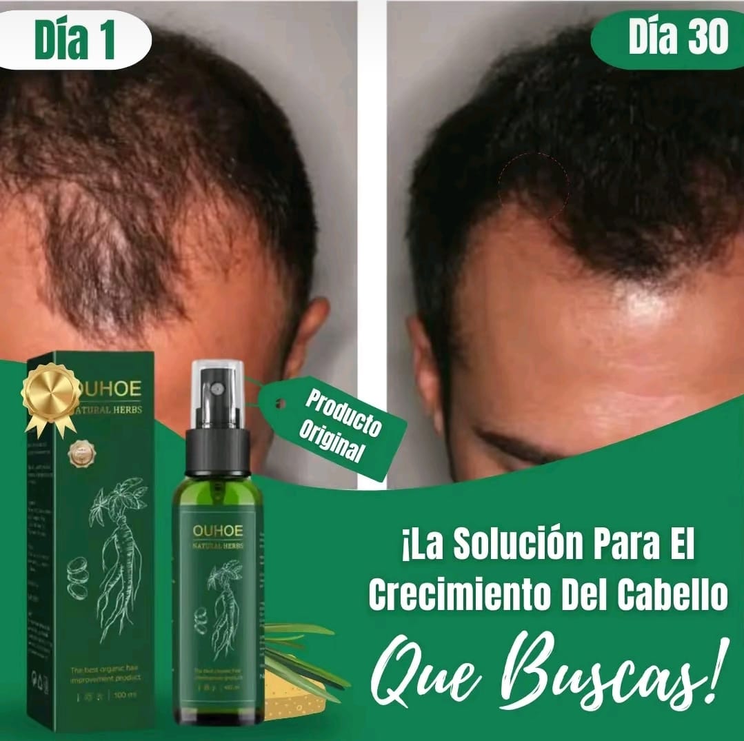 🌿 OUHOE Natural HERBS- ADIOS CAIDA 🌿