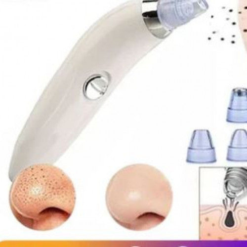Extractor Automático de Puntos Negros✨