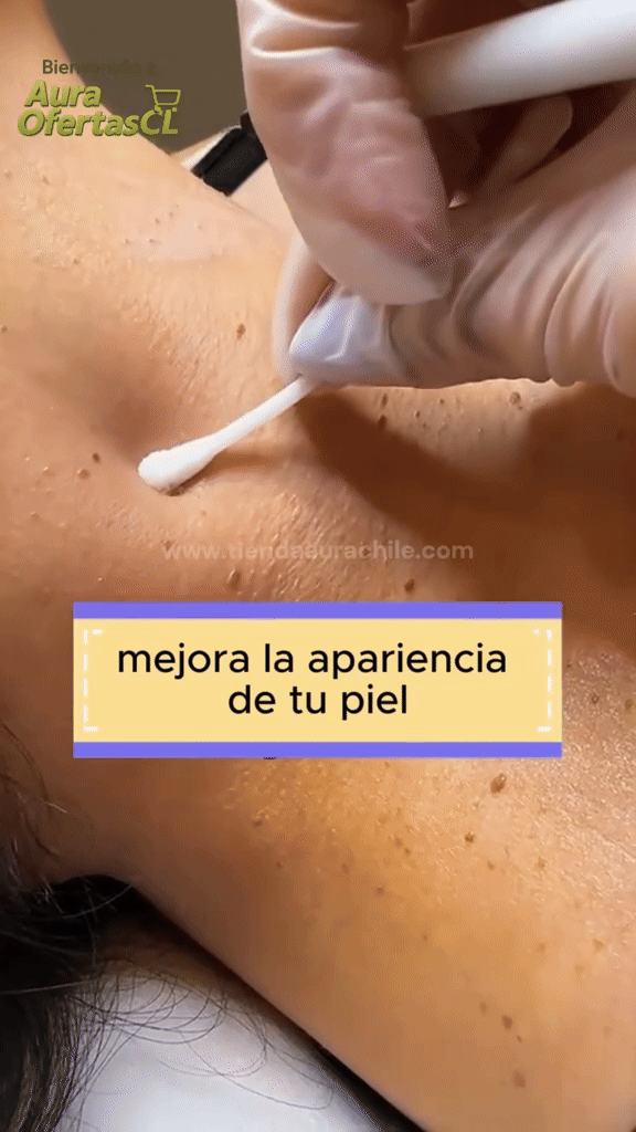 🚨 SI TIENES ESTO EN TU PIEL, NO LO IGNORES
